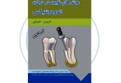 کالای دندانپزشکی روش های نوین در درمان اندودونتیکس